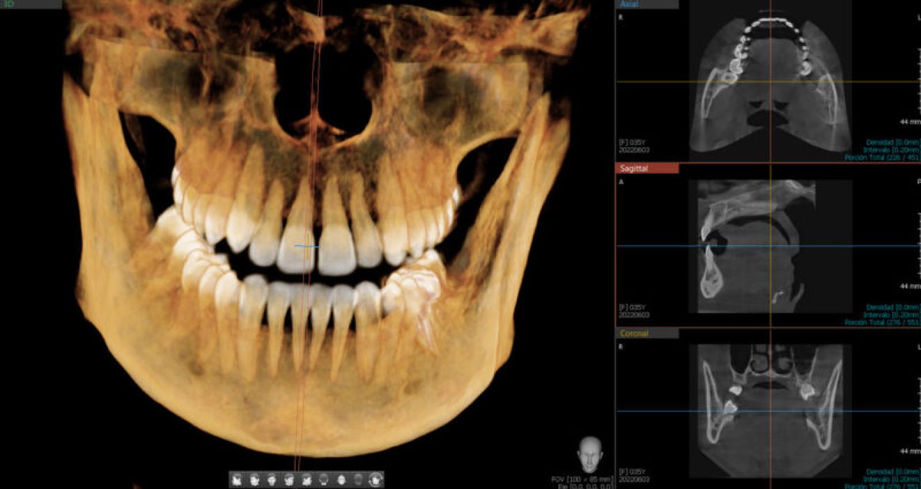 foto radiología dental